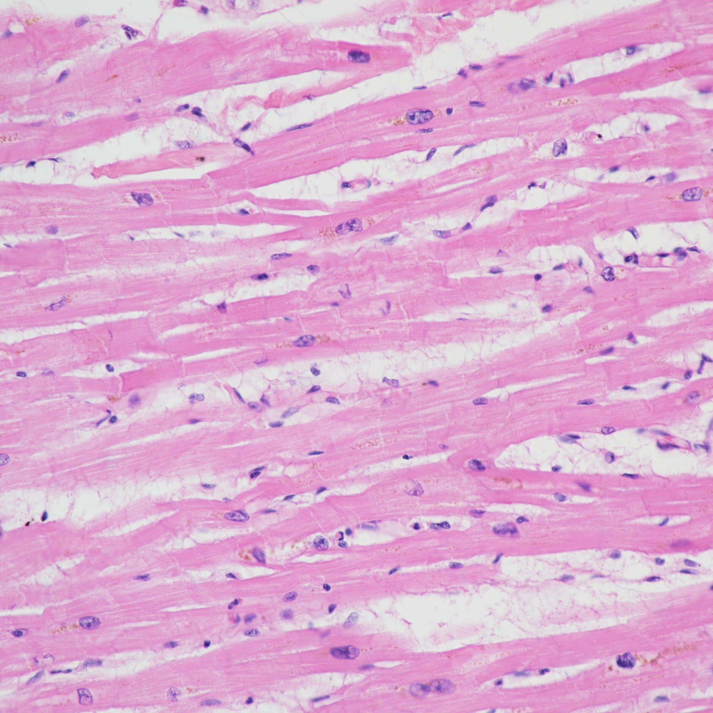 H&Estained cardiac muscle tissue Galleries Nikon Europe B.V.