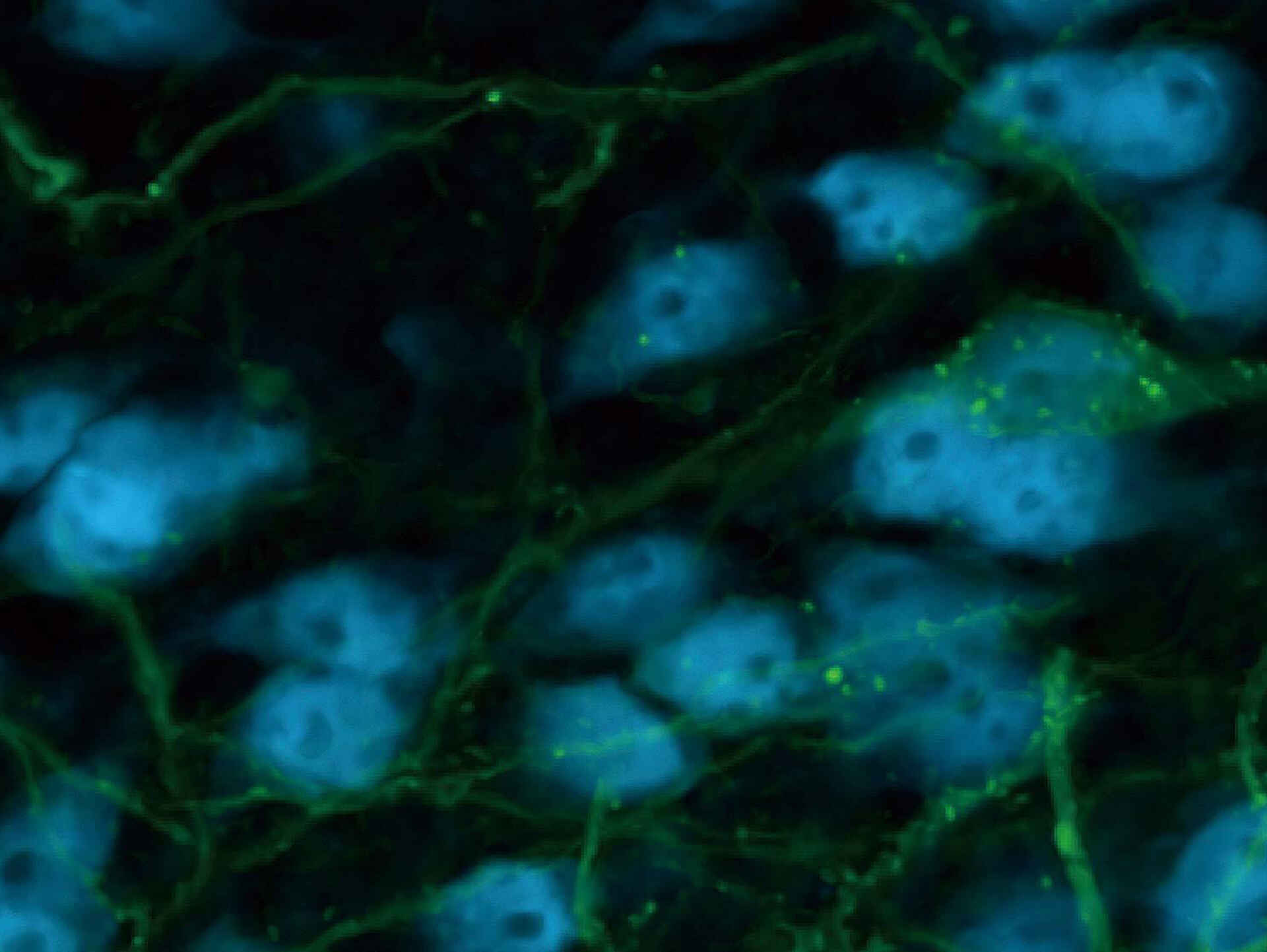 AX / AX R | Confocal Microscopes | Nikon Instruments Products | Nikon ...