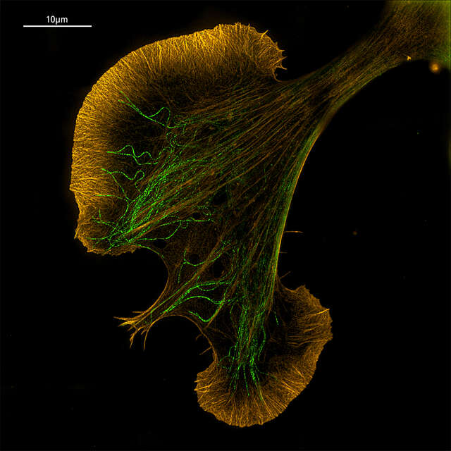 N Sim E Super Resolution Microscopes Products Nikon Instruments Inc