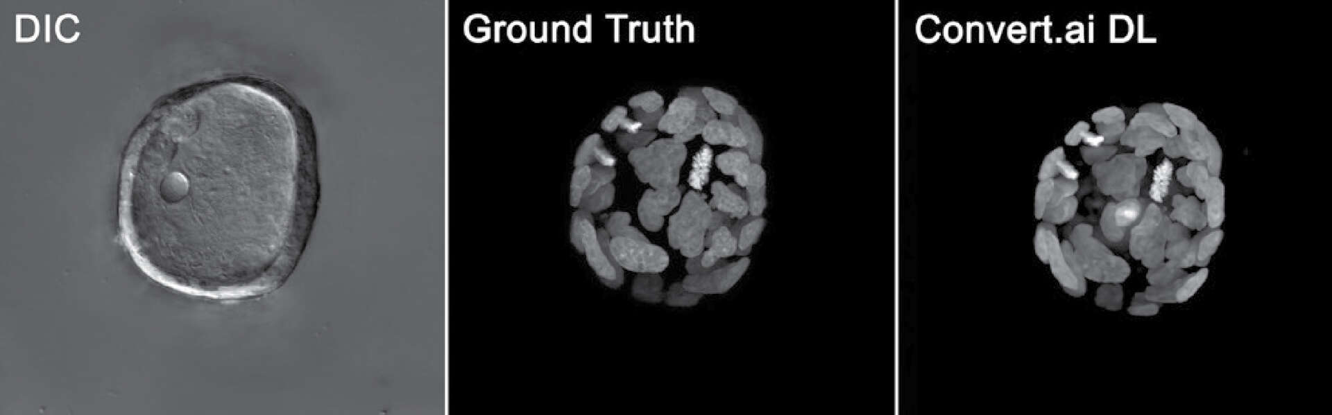 Deep Learning In Microscopy Life Sciences Solutions Nikon Instruments Inc